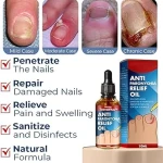 ২ পিছ (ফুল কোর্স) নখ রিপেয়ার অয়েল